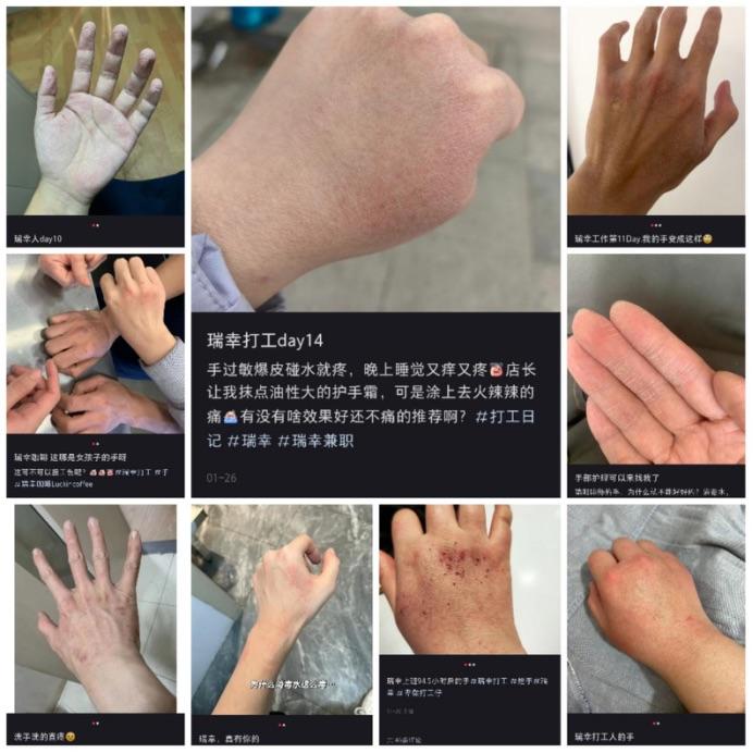 Luckin Coffee Faces Scrutiny Over Employee Hand-Washing Practices and Skin Damage Luckin Coffee Faces Scrutiny Over Employee Hand-Washing Practices and Skin Damage